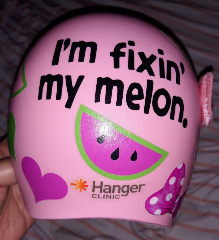 Fixin my melon cranial band