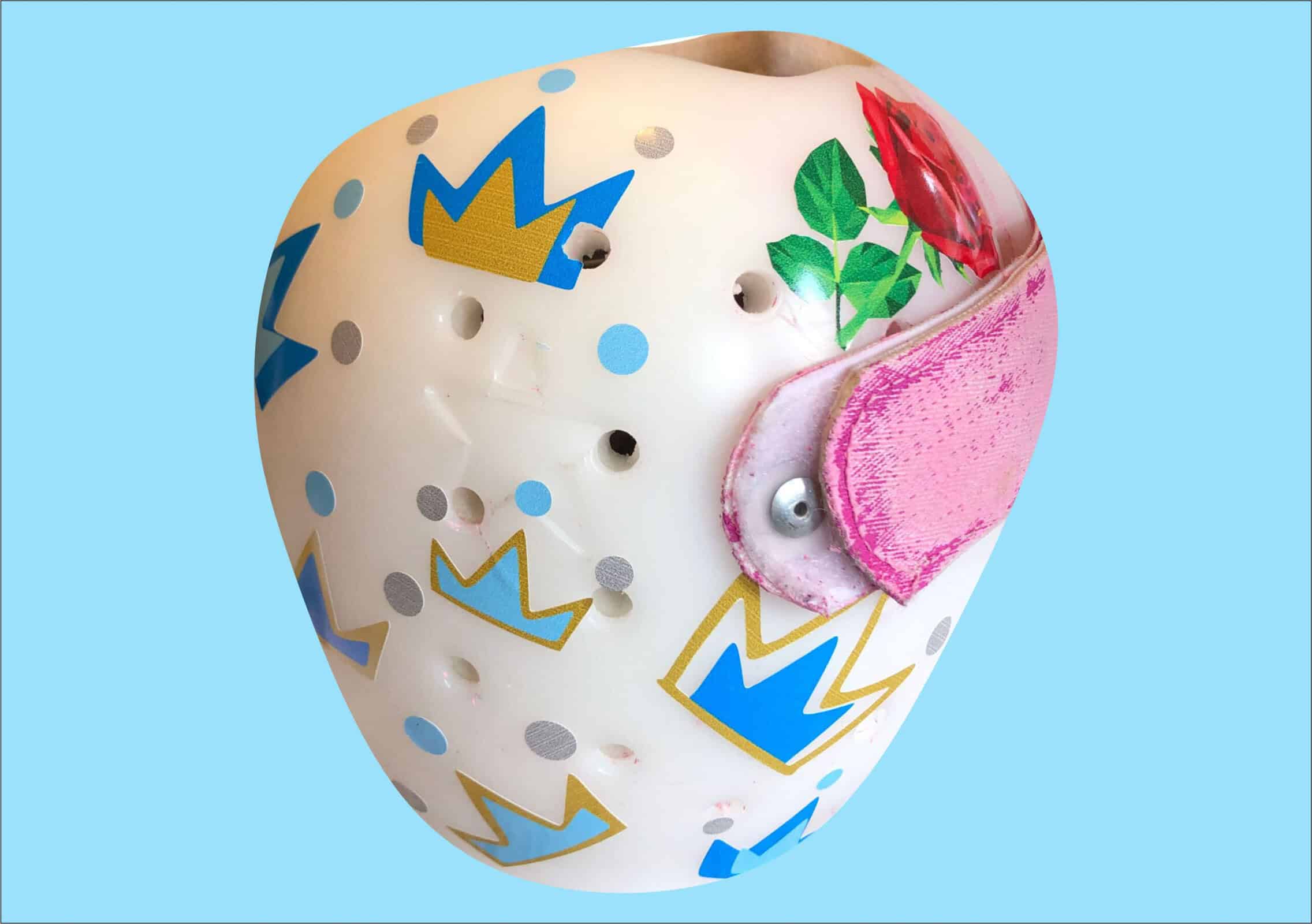 Fixing my Crown Boy cranial band decals - Image 4