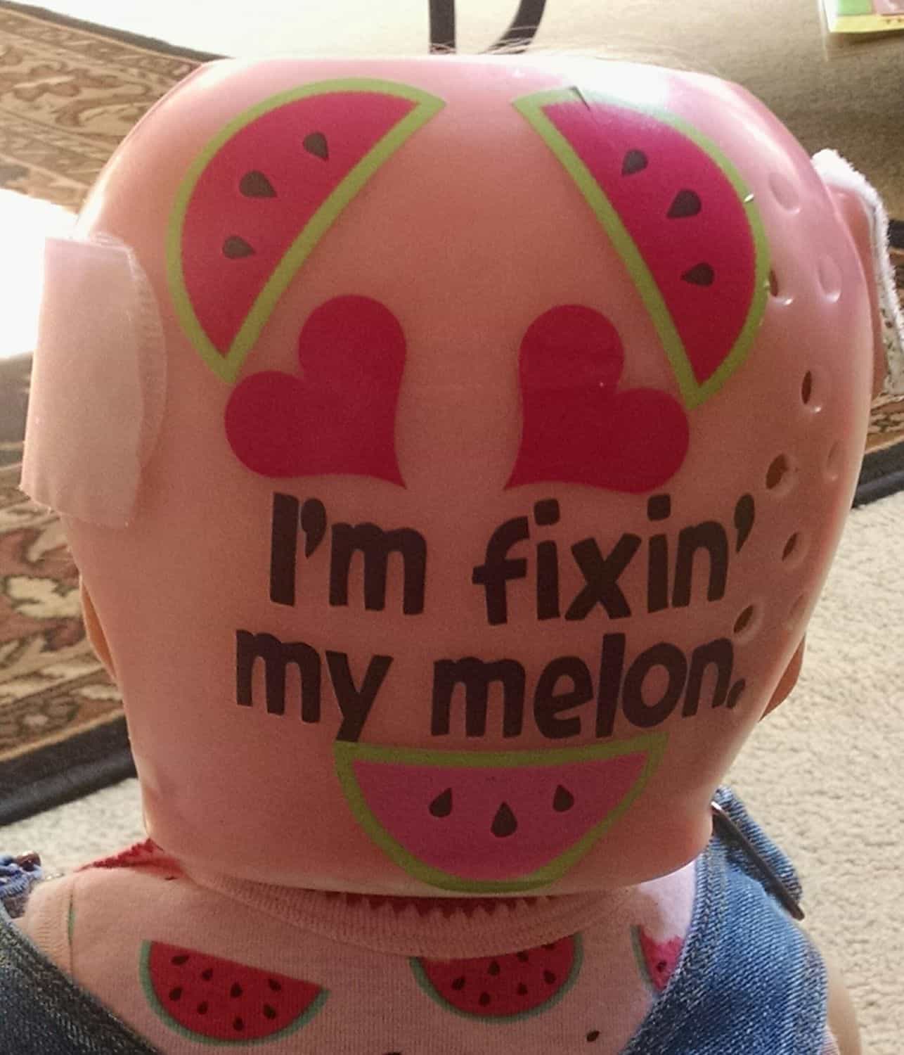Just Fixin My Melon 5 cranial band stickers - Image 7