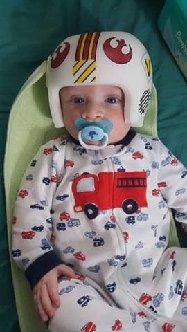 Rebel Pilot 2 cranial band decals - Image 11