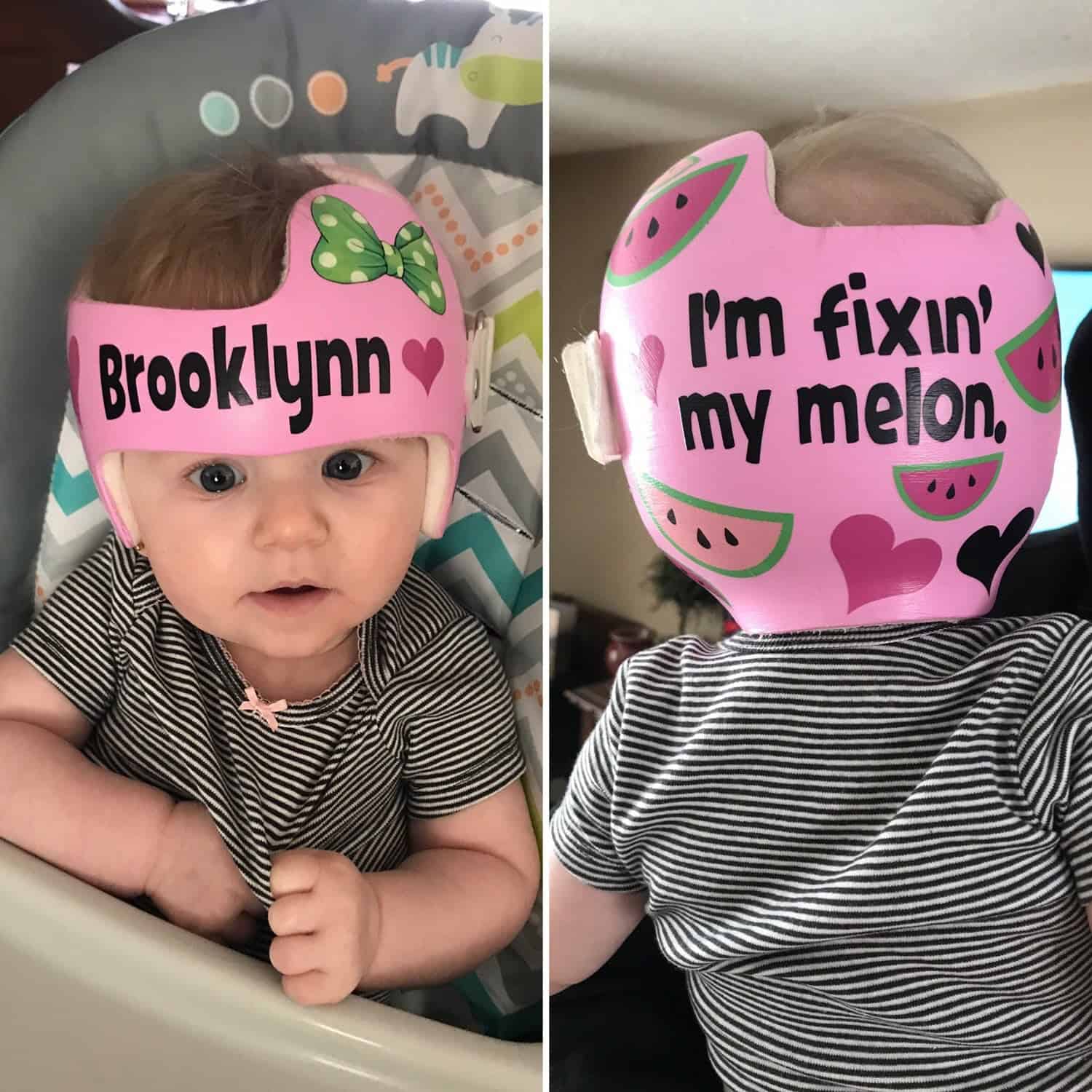 Just Fixin My Melon 5 cranial band stickers - Image 10