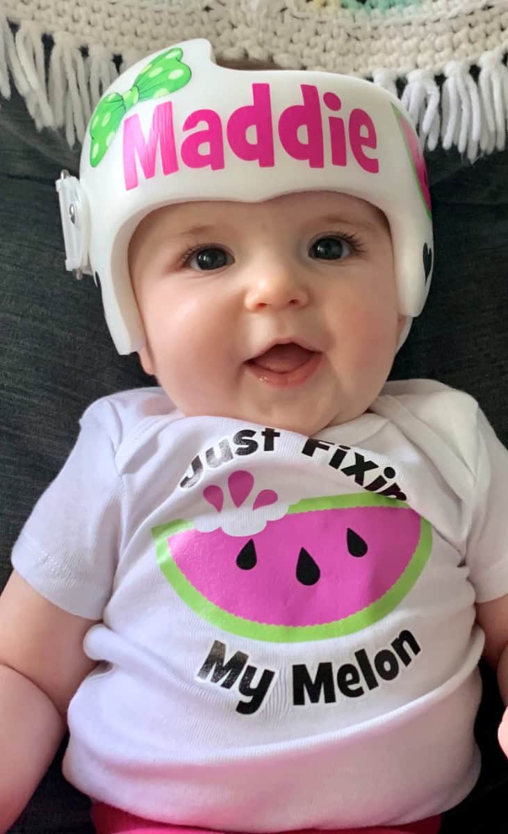 Just Fixin My Melon 5 cranial band stickers - Image 15